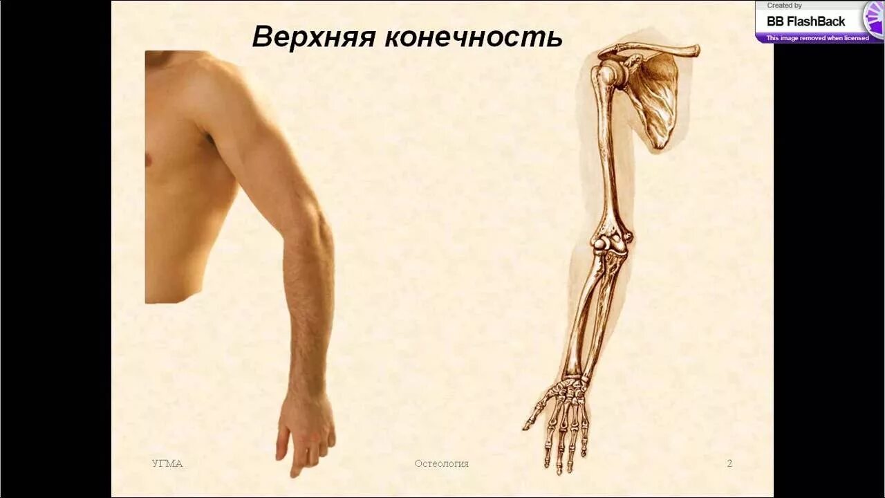 Название костей руки у человека фото Кости верхней конечности - YouTube