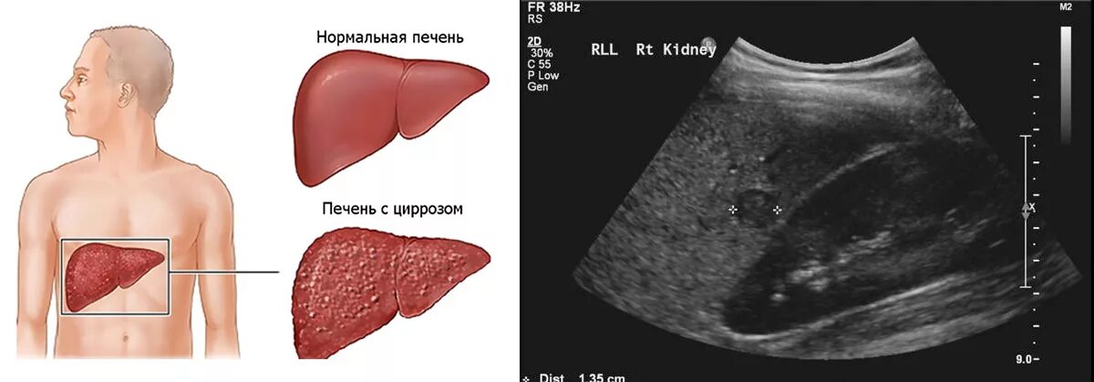 Названия печени фото Сделать узи в Выборгском районе