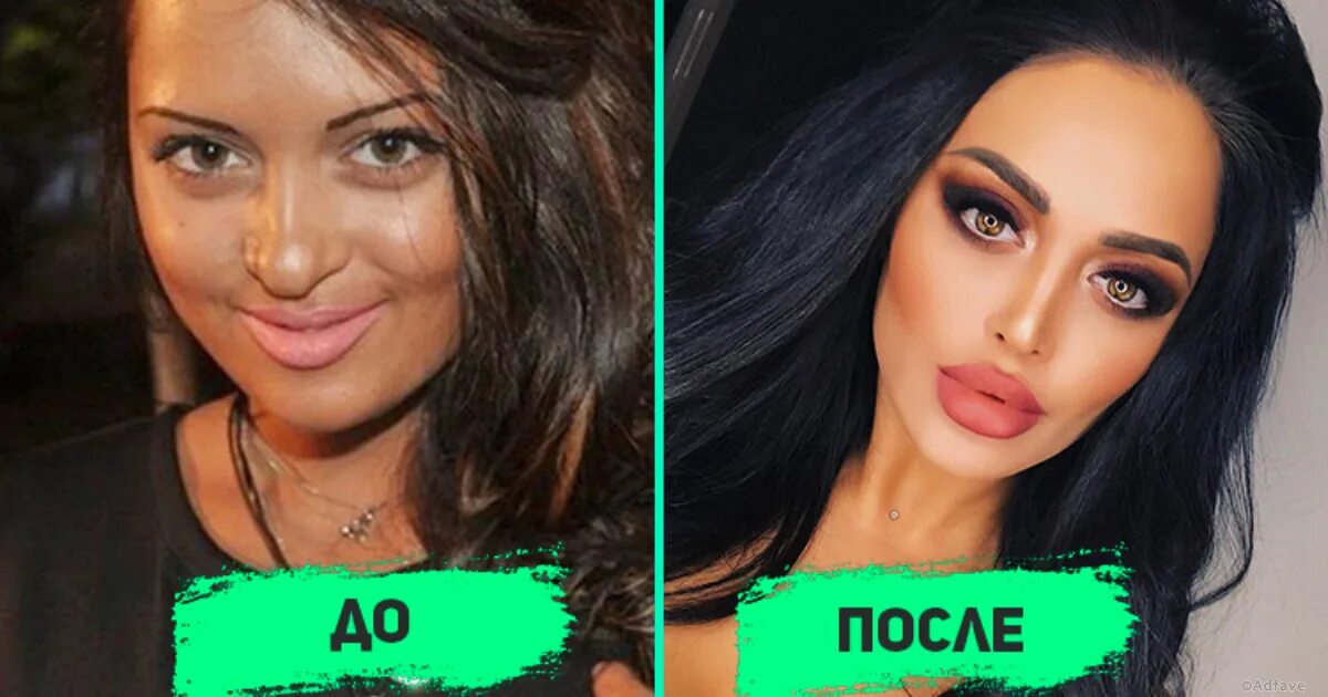 Нита до пластики фото Нита Кузьмина до пластики и после. Фото, операции, биография звезды