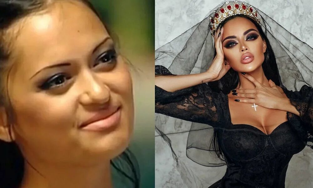 Нита кузьмина до пластики и после фото Были обычными парнями и девчонками: 10 фото, как выглядели звезды до славы Люди.