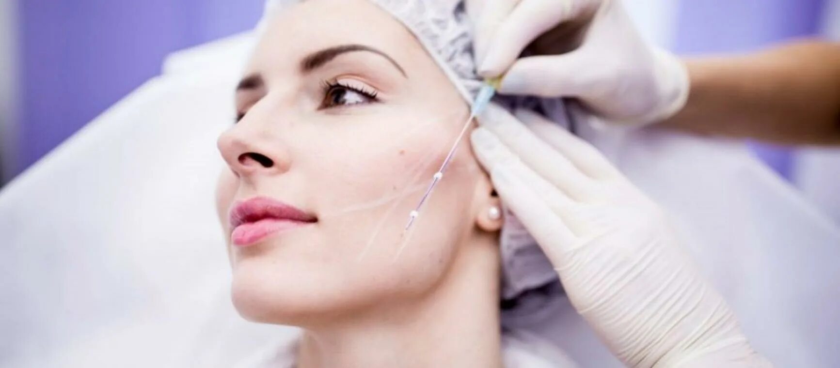 Нитевой лифтинг лица фото Suture Lifting Facial Mesh Thread 19g 38mm Hilo Tensor 3d 4d Cog Pcl De Hilos Te