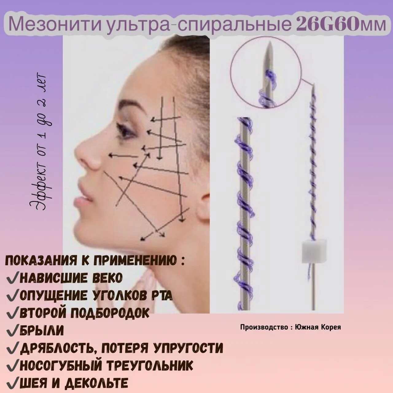 Нити коги для подтяжки лица отзывы фото Нити дарвин отзывы - Нити для подтяжки лица цены в москве отзывы.