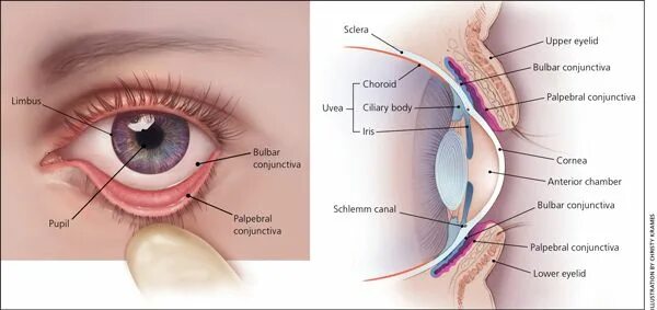 Нижнее веко глаза фото Evaluation of the Painful Eye - American Family Physician Eye anatomy, Anatomy l