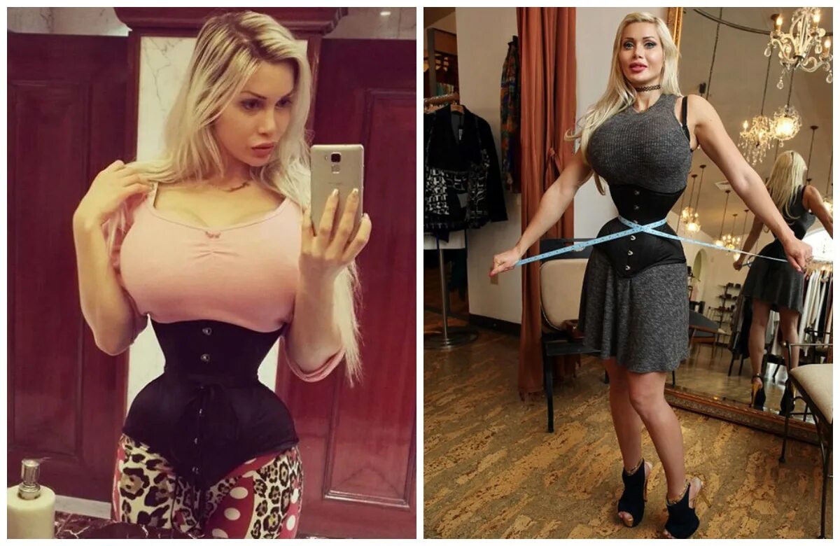 Нижние ребра фото Удаление ребра для талии