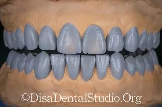 Нижние резцы фото Encerado Laboratorio dental, Anatomía dental, Estetica dental
