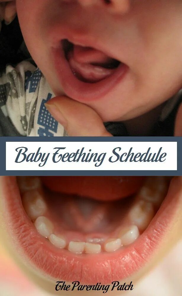 Нижние резцы фото Baby Teething Schedule Baby teeth, Baby teething schedule, Toddler teeth brushin