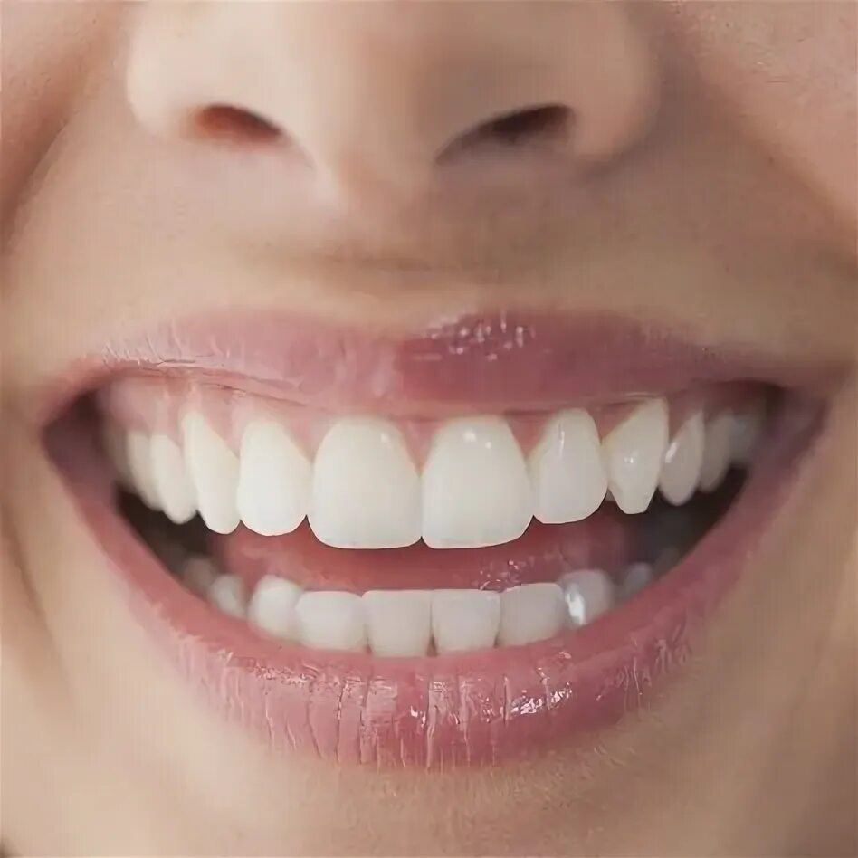 Нижние зубы фото 10 популярных идей на тему "good teeth" для вдохновения