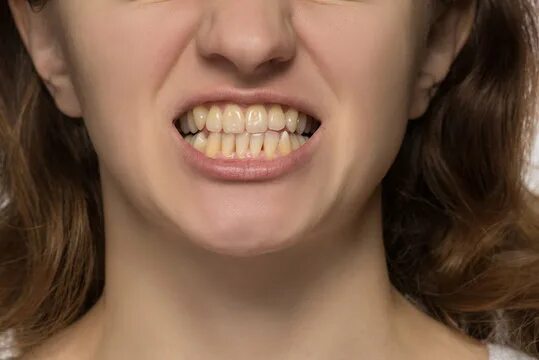 Нижние зубы фото Rotten Teeth Billeder - Gennemse 40,111 stockfotos, vektorer og videoer Adobe St
