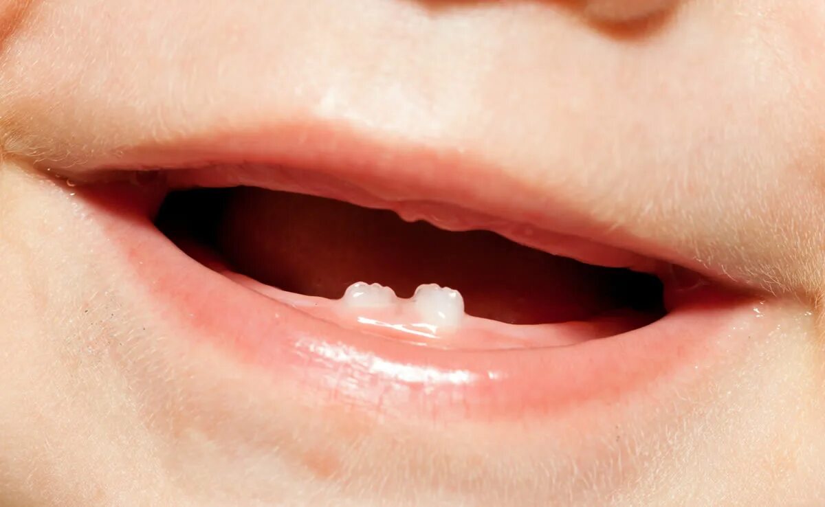 Нижние зубы фото How To Brush Your Child's Teeth - 123Dentist