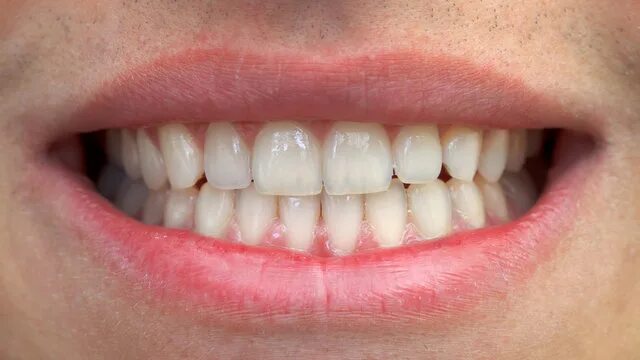 Нижние зубы фото Mouth And Teeth Изображения: просматривайте стоковые фотографии, векторные изобр