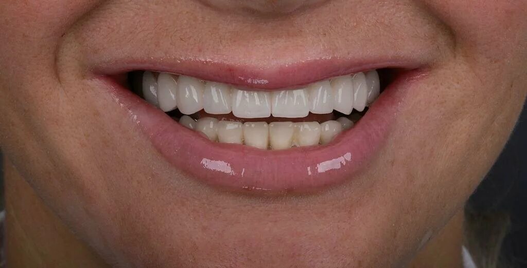 Нижние зубы фото Dental Care, dental clinics, Мытищи, Благовещенская улица, 3 - Yandex Maps