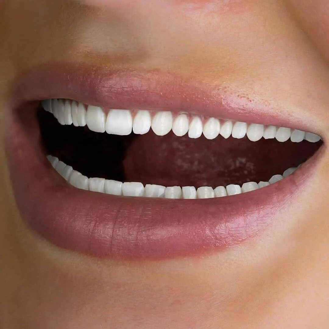 Нижние зубы фото по номерам This Teeth Whitening pen from@makefullbeauty is the best & easiest way to whiten
