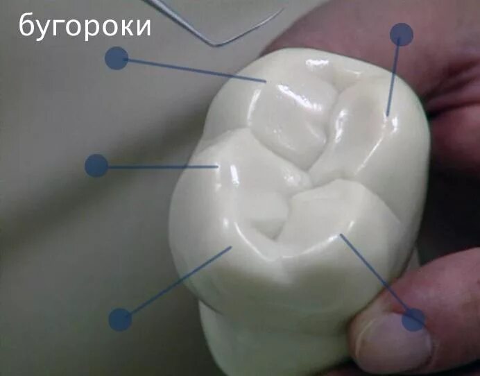 Нижний 6 зуб фото Замечали на зубах бугорки и углубления?
