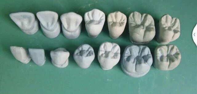 Нижний 6 зуб фото Piezas dentales Arte dental, Estetica dental, Laboratorio dental