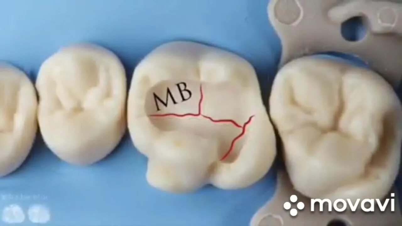 Нижний 6 зуб фото perfect composite carving - YouTube