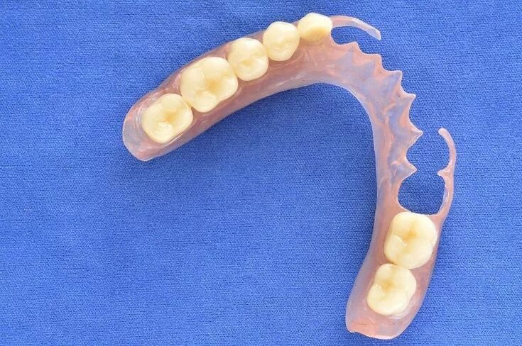 Нижний частичный протез фото Know All About Flexible Dentures: A Guide Affordable dentures, Partial dentures,