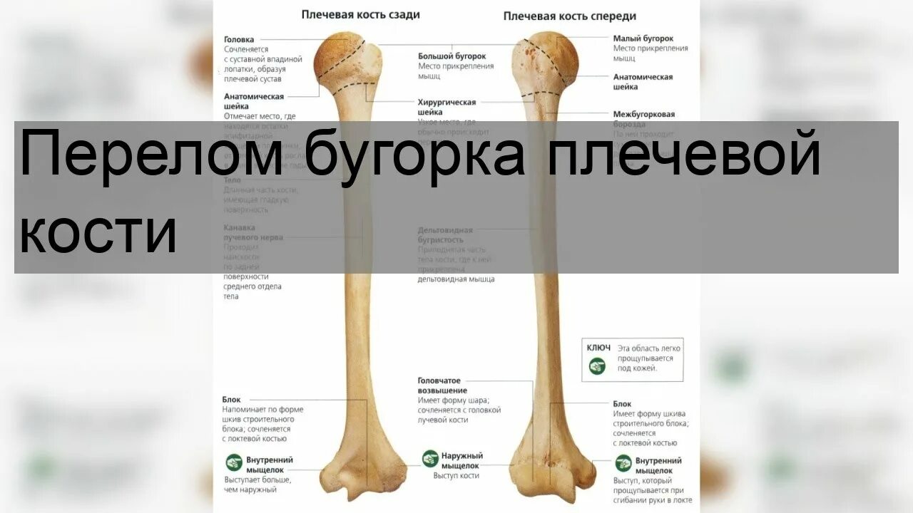 Нижний конец плечевой кости фото Перелом бугорка плечевой кости - YouTube