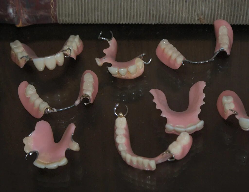 Нижний протез фото In Texas State Prisons, Dentures Are Rarely Deemed 'Medically Necessary' Texas S