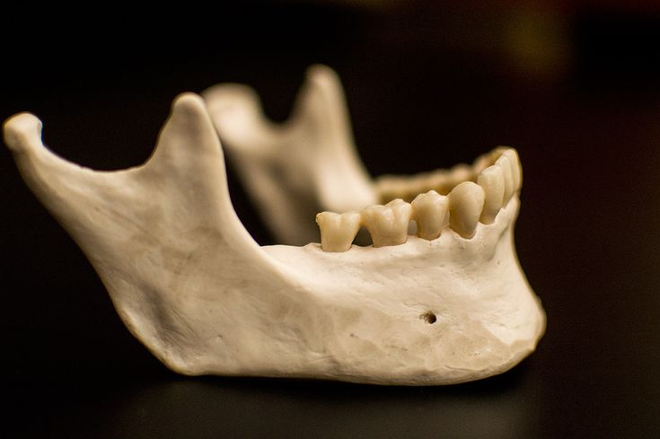 Нижняя челюсть человека фото New data improve techniques for determining whether a jaw bone comes from a man 