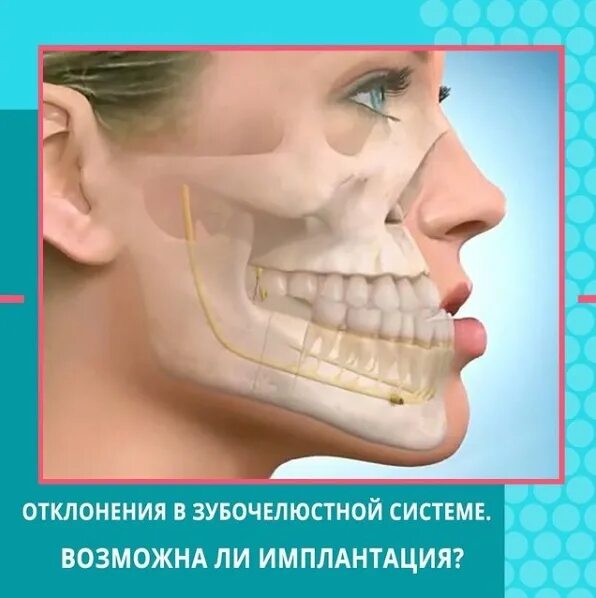 Нижняя челюсть фото Отклонения в зубочелюстной системе - Приоритет