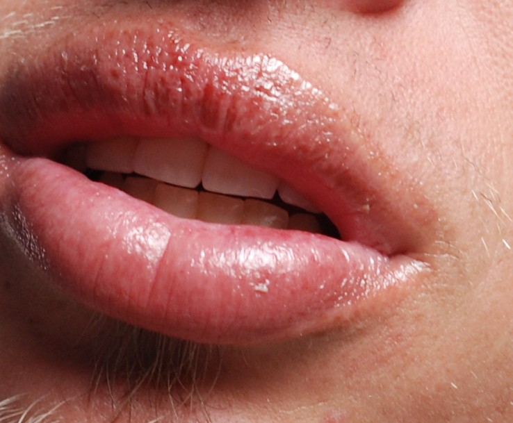 Нижняя губа внутри фото Sunburned Lips Can you guess who's these are? This photo w. Flickr