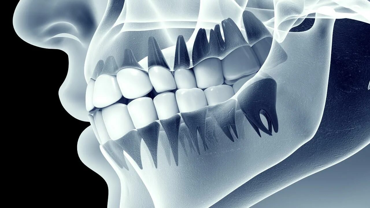 Нижняя зубная челюсть фото Teeth Tell Story of People Who Didn't Get Enough Sunshine