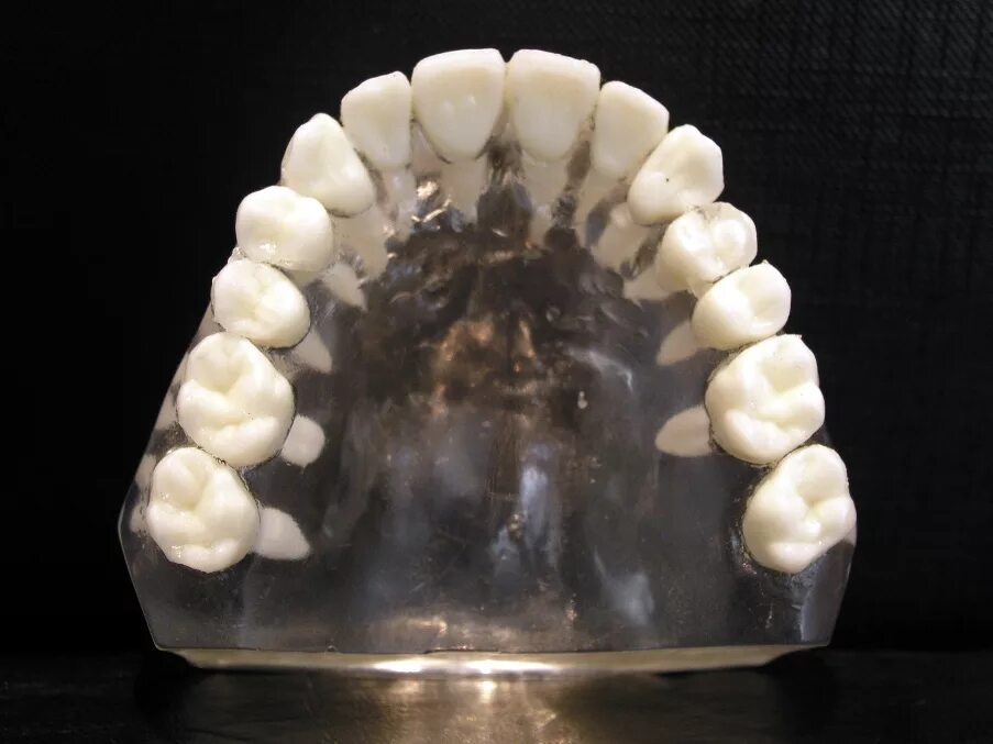 Нижняя зубная челюсть фото File:Upper jaw.jpg - Wikipedia