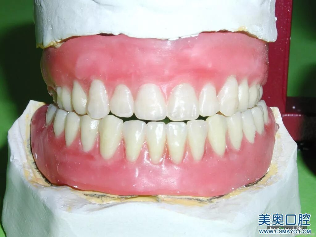 Нижняя зубная челюсть фото Dental Restoration Zirconia Crown By Shenzhen Guoyou Denture Co., Ltd