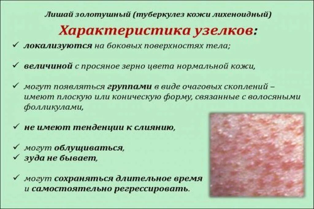 Острый дерматит фото и как лечить Вирусный дерматит у детей: причины, симптомы с фото и лечение инфекционного забо