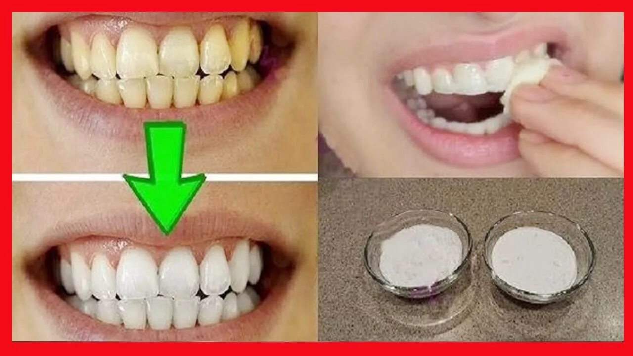 Отбелить зубы на фото DENTES BRANCOS EM 2 MINUTOS ➜ A Maneira Mais Fácil Para BRANQUEAR os Dentes - Yo