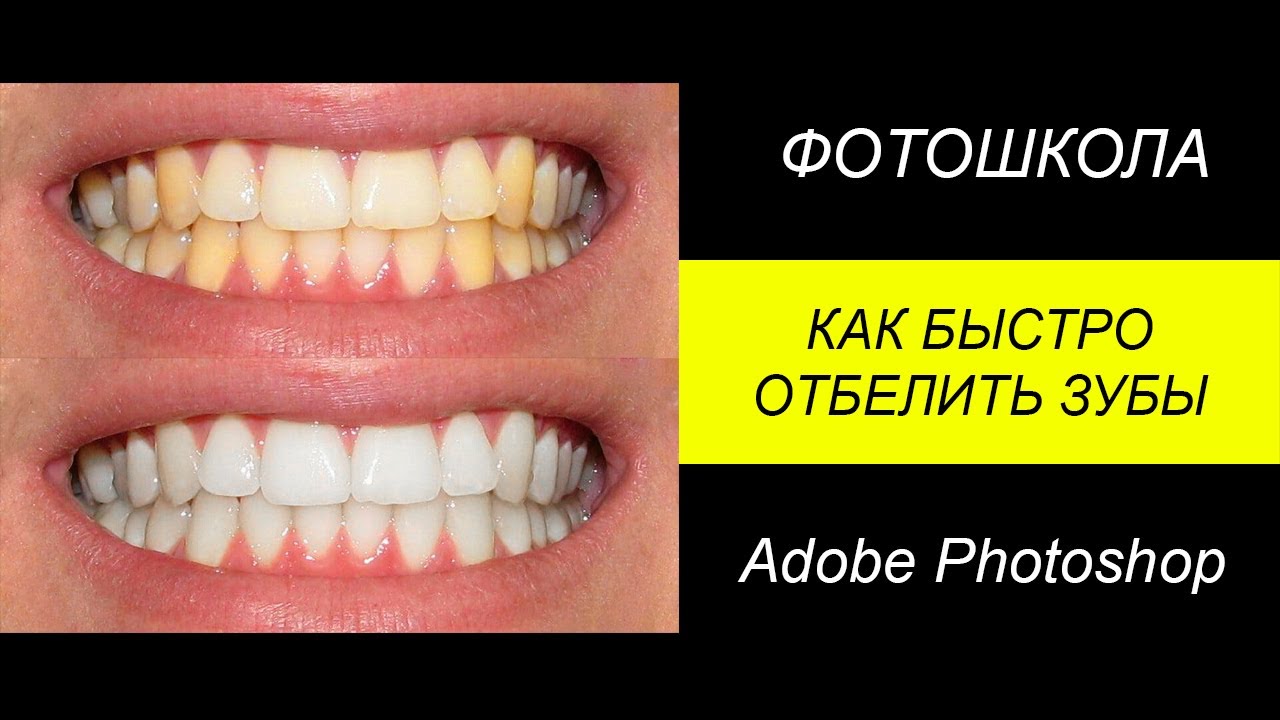 Отбелить зубы на фото Как быстро отбелить зубы в Фотошоп - YouTube