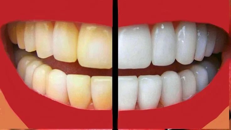 Отбелить зубы на фото онлайн бесплатно How We Keep Our Teeth Bright