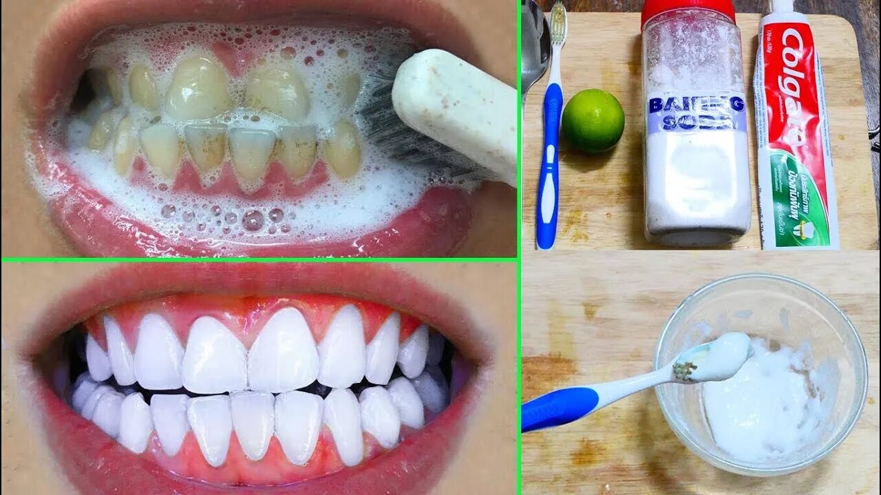 Отбелить зубы на фото онлайн бесплатно Even Dentists Surprise With This Teeth Whitening Paste Magical Teeth Whitening -