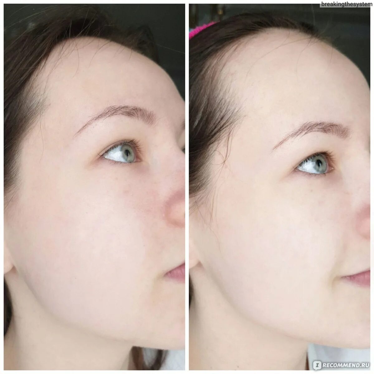 Отбеливание лица до и после фото Маска для лица Beauty Derm Томат Whitening - "ОБАЛДЕННАЯ маска с эффектом ОТБЕЛИ