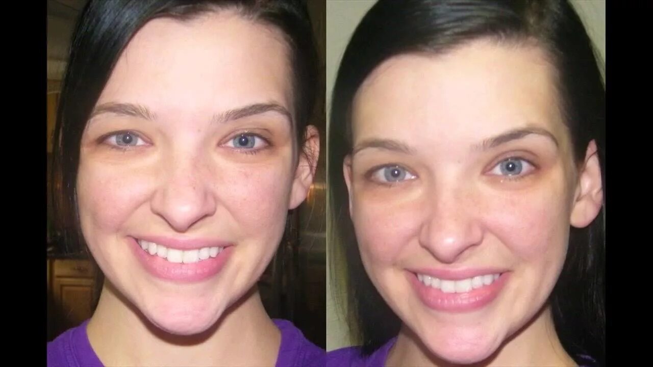 Отбеливание лица до и после фото Aging Anti care Skin This Is What You may Know - YouTube