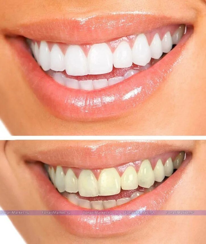 Отбеливание зубов фото Отбеливающие полоски для зубов 3D White Teeth Whitening Stripes ОПТОМ 14шт