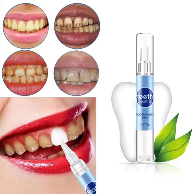 Отбеливание зубов в домашних условиях фото 1 Pcs White Teeth Whitening Pen Portable Stains Removing Tooth Oral Hygiene Stai