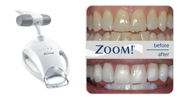 Отбеливание зубов зум фото Отбеливание нового поколения Philips Zoom 4 White Speed
