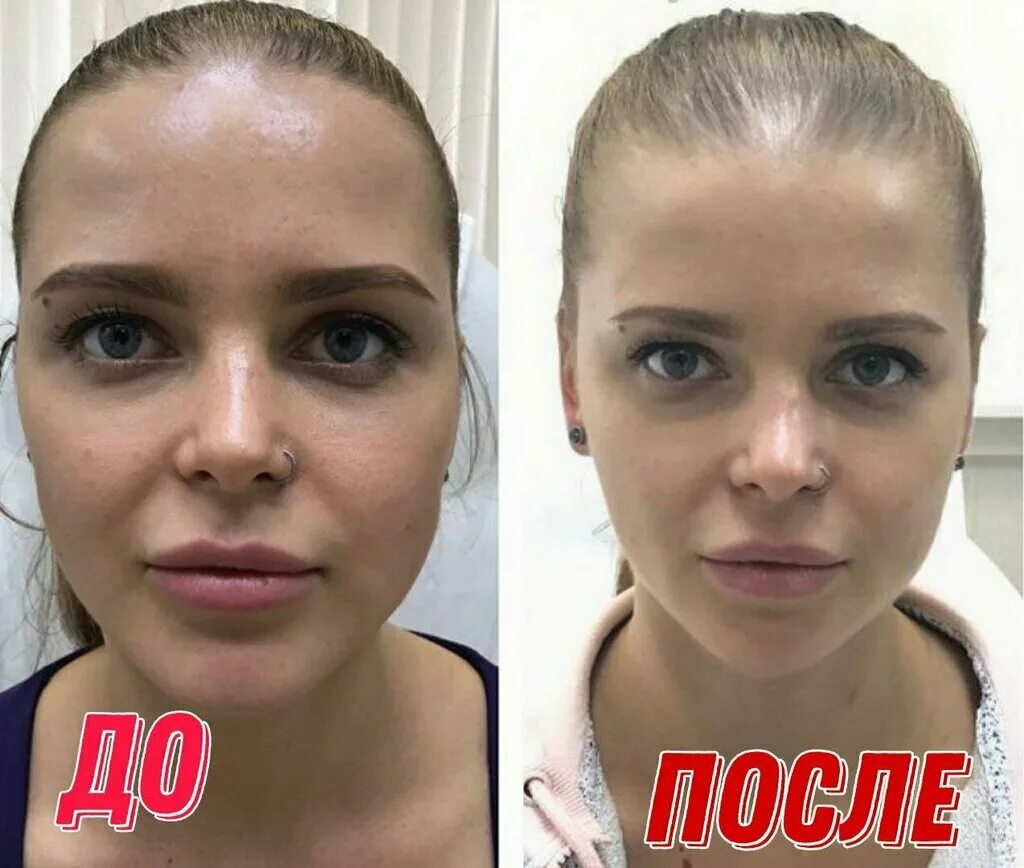Отзывы фото до и после Профессиональный массаж, massage salon, Vladimir, Bolshaya Moskovskaya ulitsa, 5