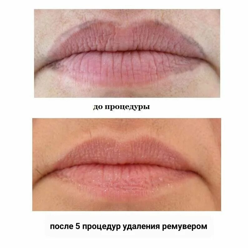 Отзывы после перманентного макияжа губ Рефреш бровей в Таганроге: 4 мастера по бровям с отзывами и ценами на Яндекс Усл