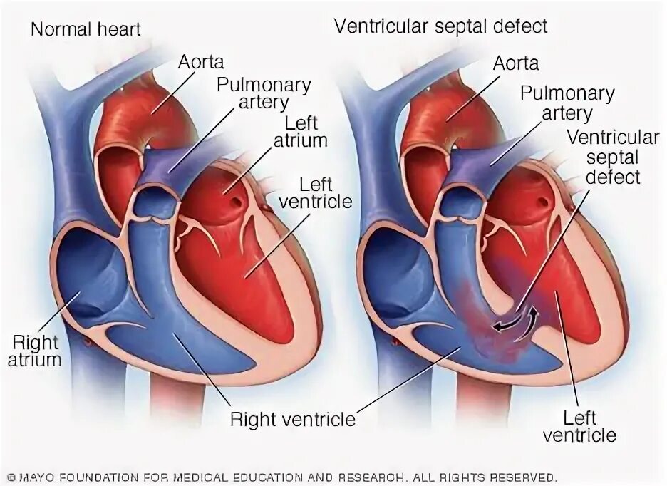 Овальное окно в сердце фото Pin on HEART/CIRCULATORY