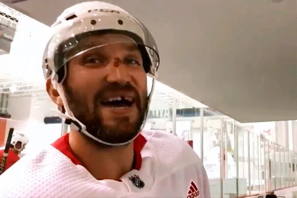 Овечкин фото без зуба Ovechkin said he feels good after injury and could have played in missed matches