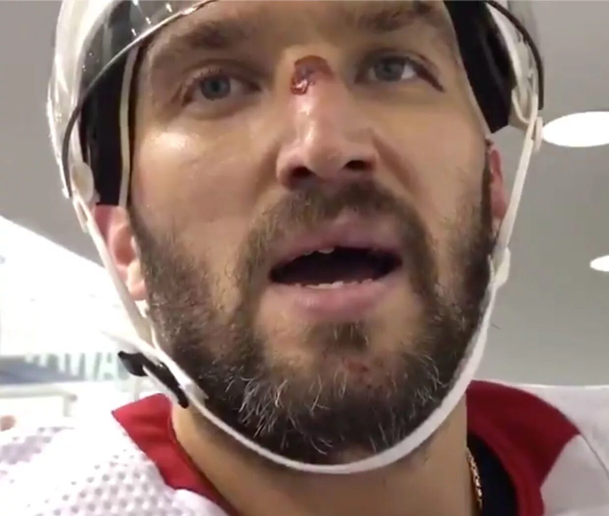 Овечкин зубы фото Alex Ovechkin left practice with a painful injury, but came back as if 'nothing 