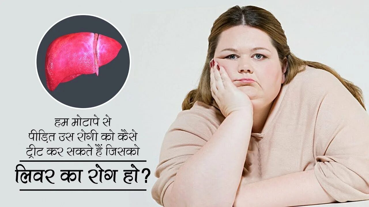 Ожирение печени фото हम माेटापे से पीड़ित उस राेगी काे कैसे ट्रीट कर सकते हैं जिसकाे लिवर का राेग हाे