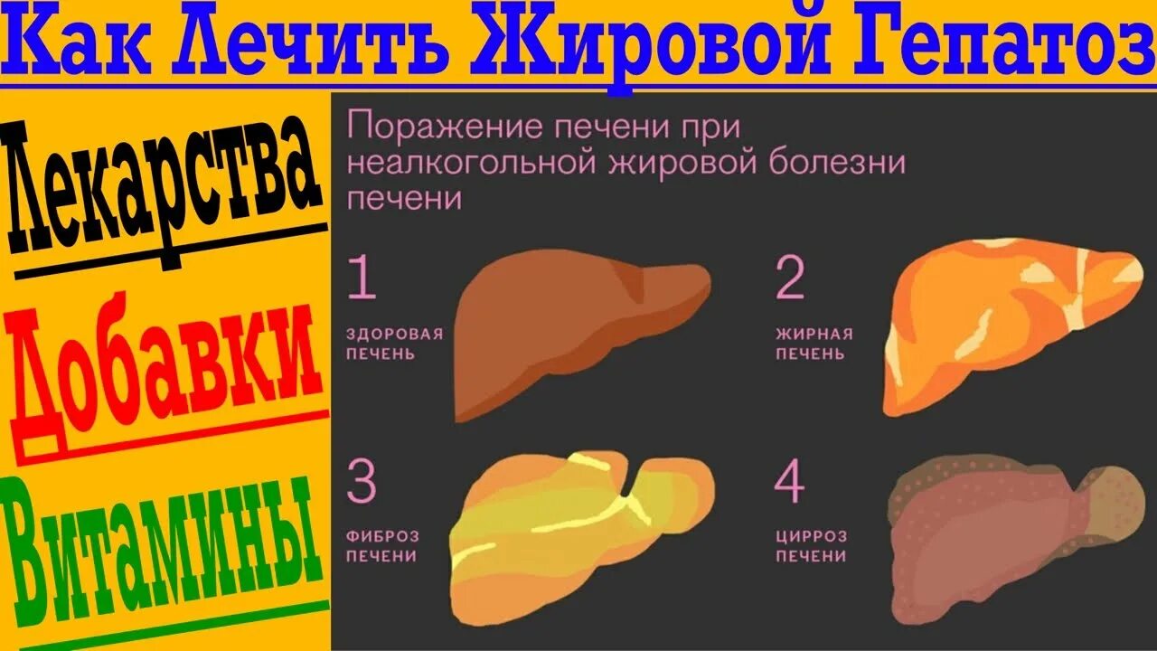 Ожирение печени фото Как быстро вылечить жировой Гепатоз печени! - YouTube
