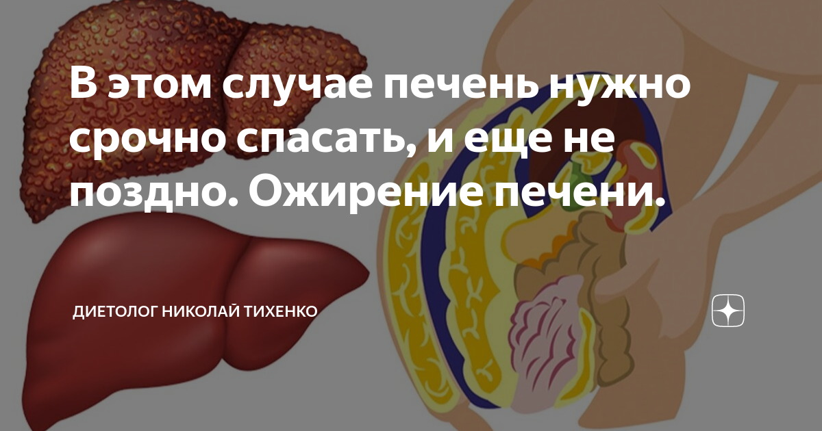 Ожирение печени фото у женщин В этом случае печень нужно срочно спасать, и еще не поздно. Ожирение печени. Дие
