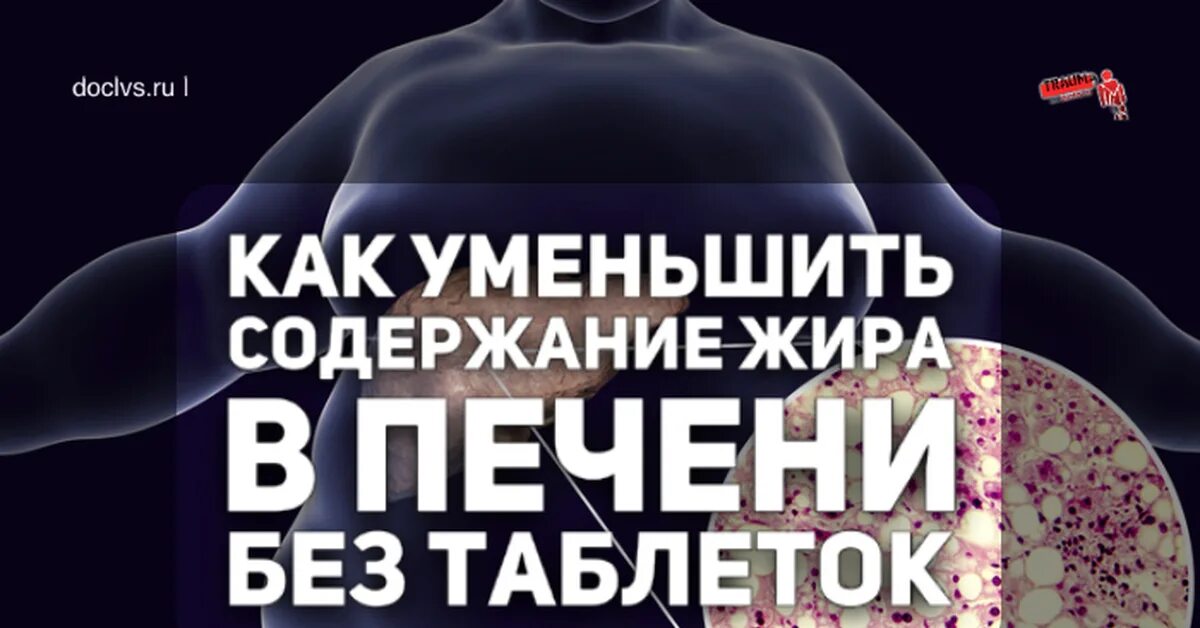 Ожирение печени фото у женщин Печень и лишний вес: найдено 85 изображений