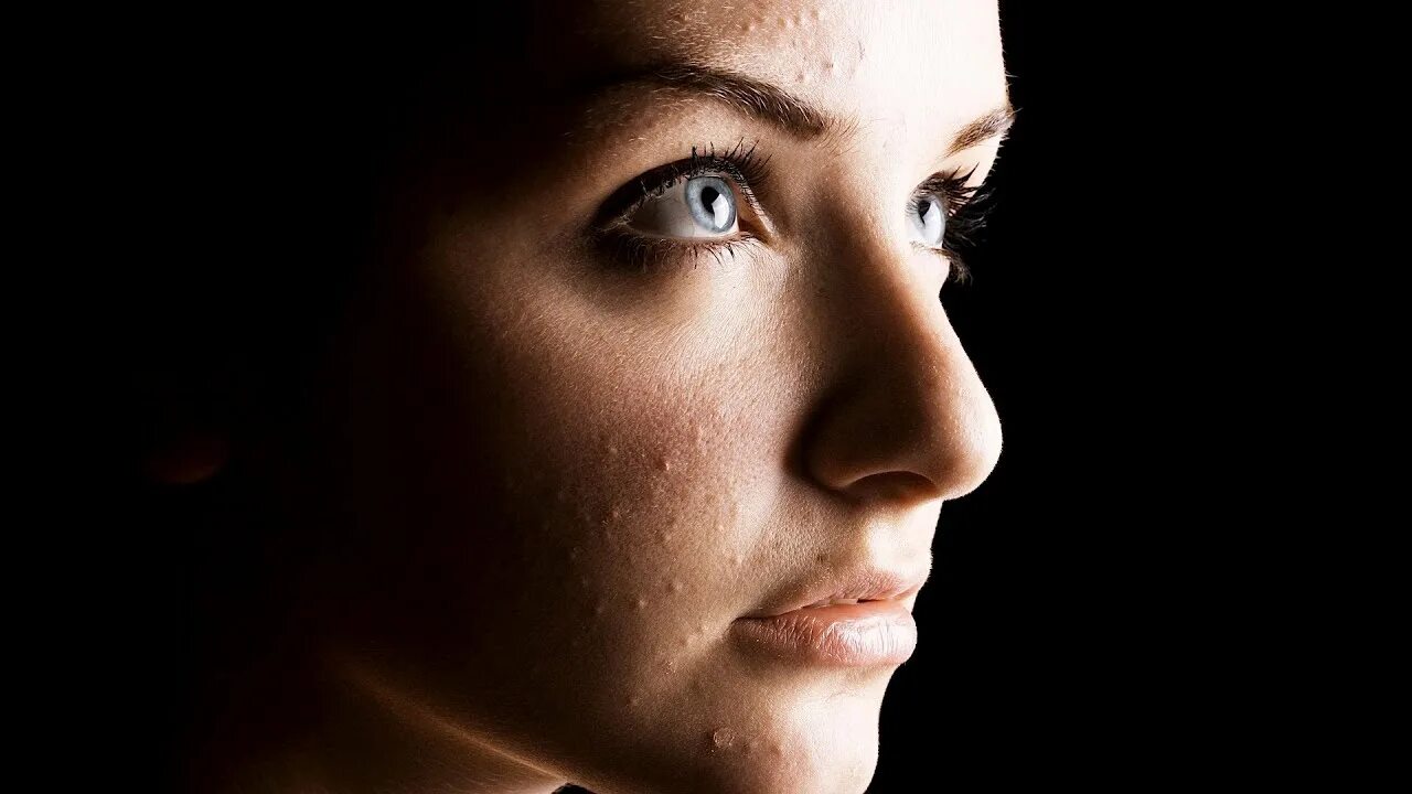 Оживи фото лица How to Deal with Pockmarks Acne Treatment - YouTube