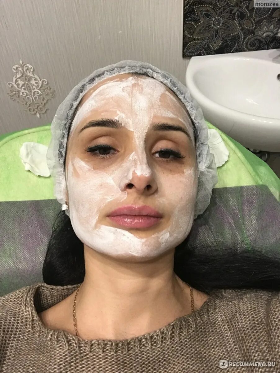 Оживить лицо на фото Мезотерапия - "Старт в 36 лет - начинаем реанимировать лицо. Фото " отзывы