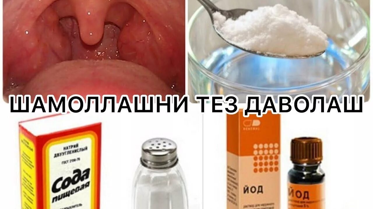 Ожог горла фото ДАМЛАМАЛАР ТАЙЁРЛАШ УЙ ШАРОИТИДА - YouTube